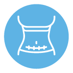 C-Sections Acne scars